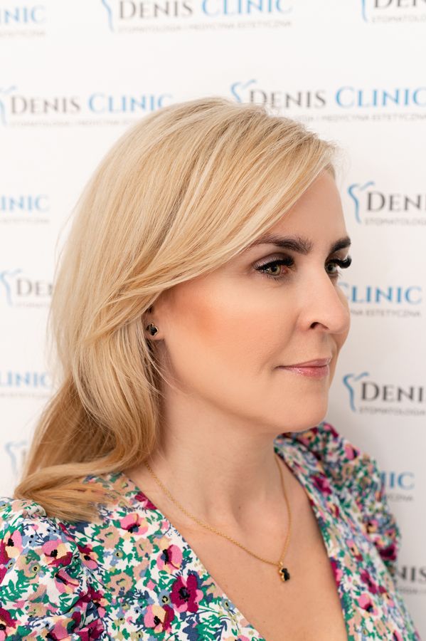 biostymulatory_denis_clinic